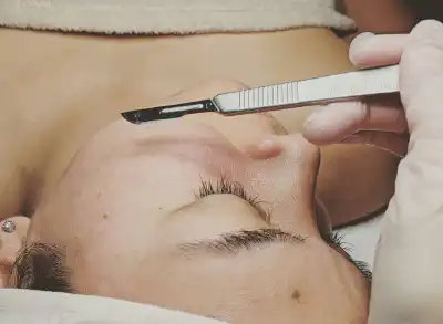 woman getting dermaplaning treatment